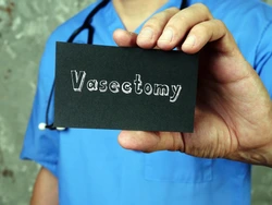 vasectomy